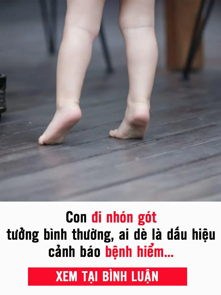 Đừng chủ quan khi trẻ đi nhón chân, bác sĩ cảnh báo